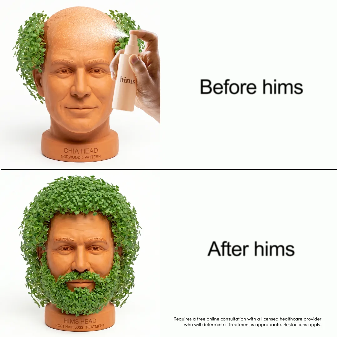 Chia Head Before & After Hair Loss Treatment Ad