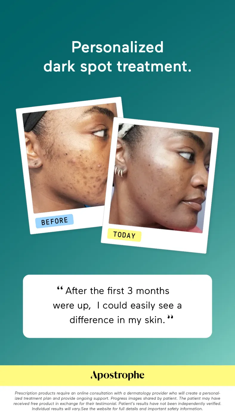 Before & After Dark Spot Treatment Ad