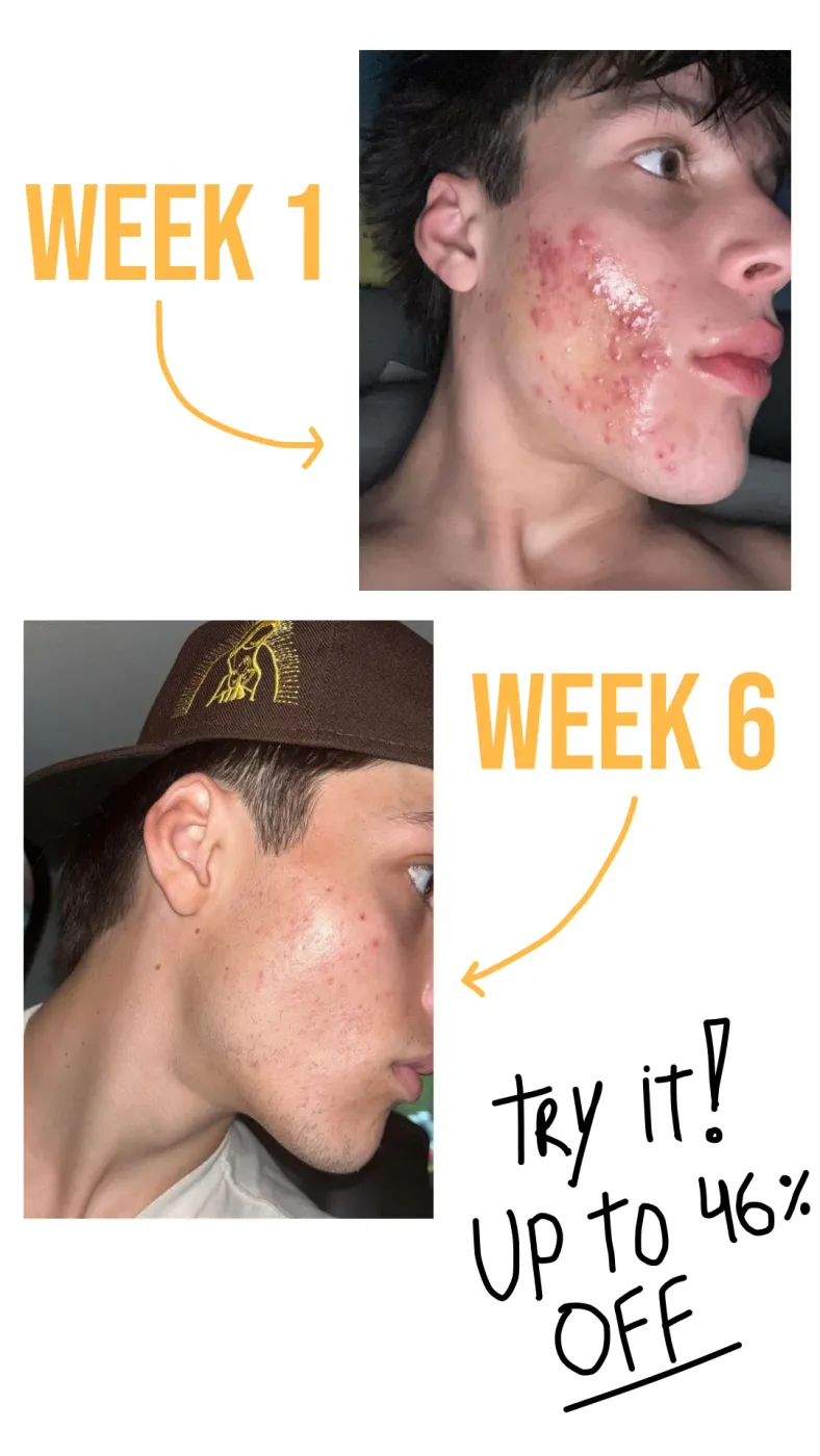 Before & After Skincare Transformation Ad