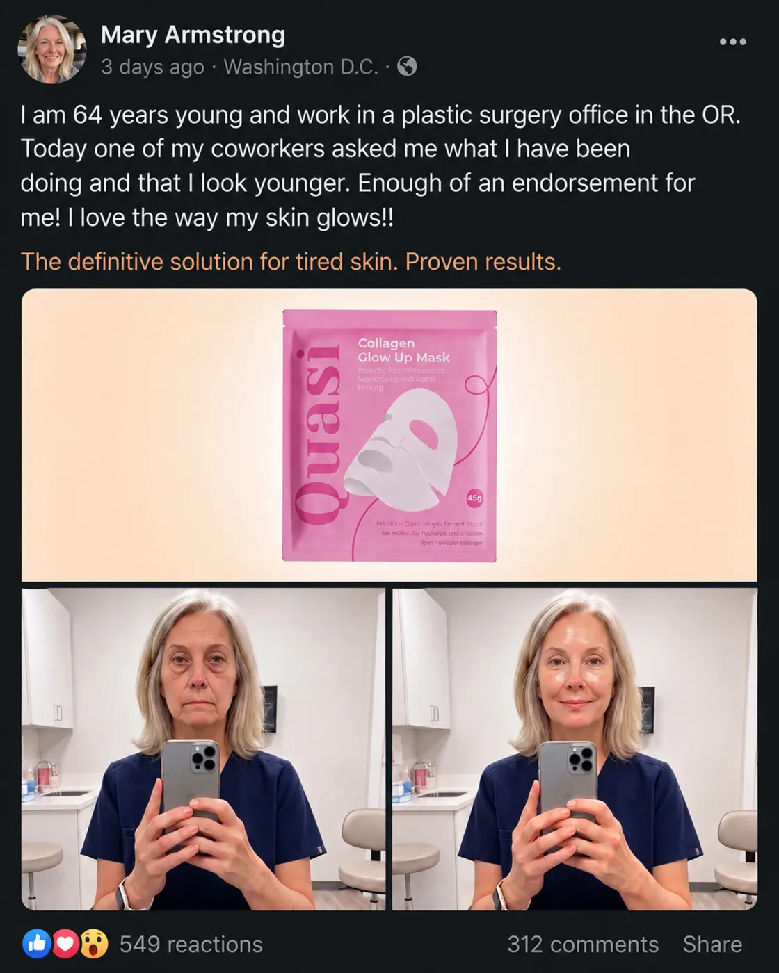Social Proof Mockup with B&A Split Grid