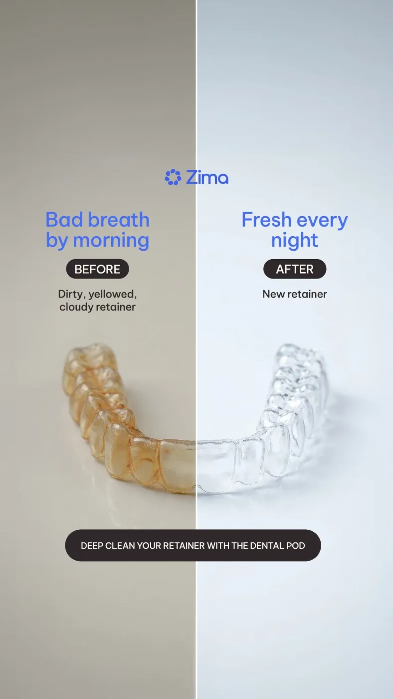 Split Before/After Retainer Care Graphic Ad