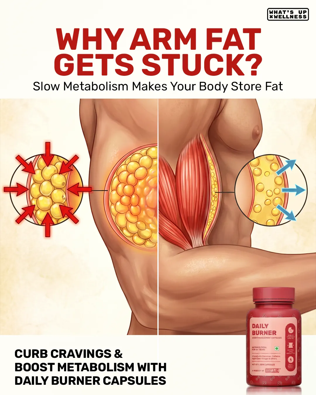 Fat Cell Comparison Arm